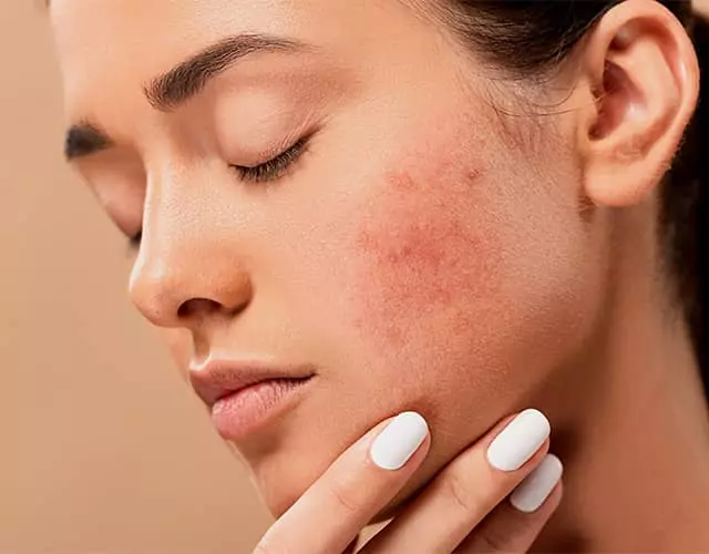 Skin retouching before editing