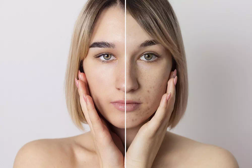 Retouching