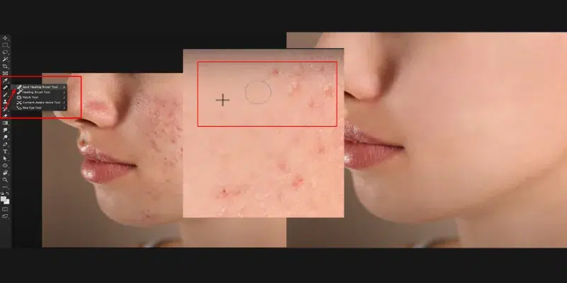 Retouch and Remove Imperfections Retouch and Remove Imperfections